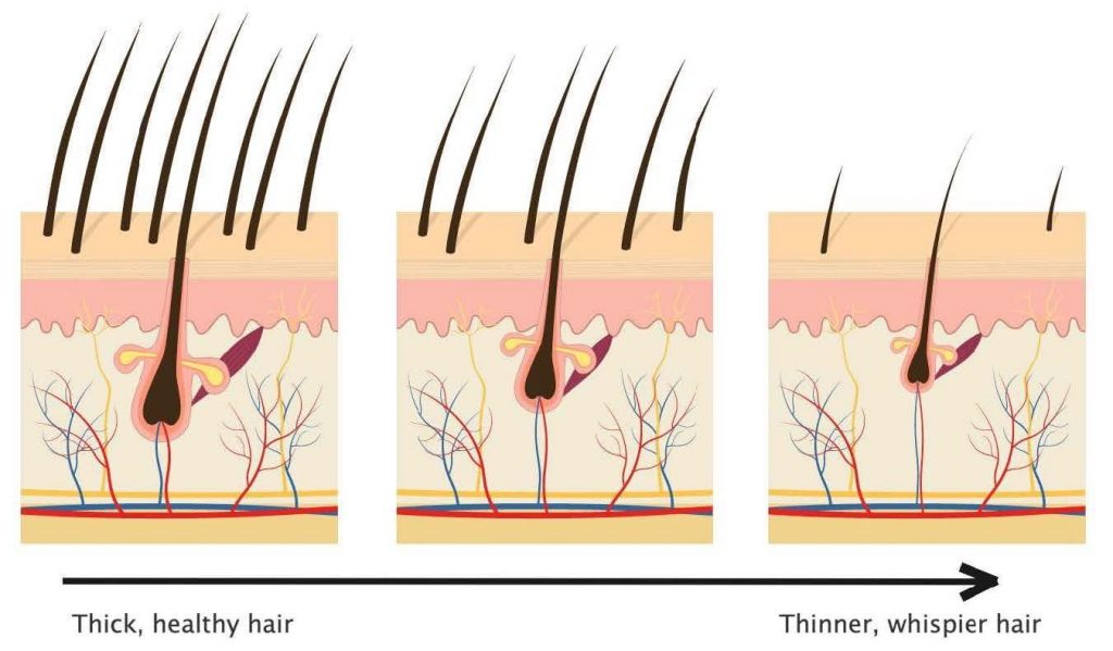 Hair Loss Treatment In Melbourne | Bay Medical Aesthetics